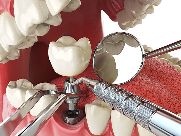 Best Dentist for Dental Trauma  in Buena Vista, MI